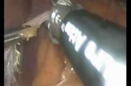 235
