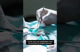 When the gallbladder is removed, who will perform its function